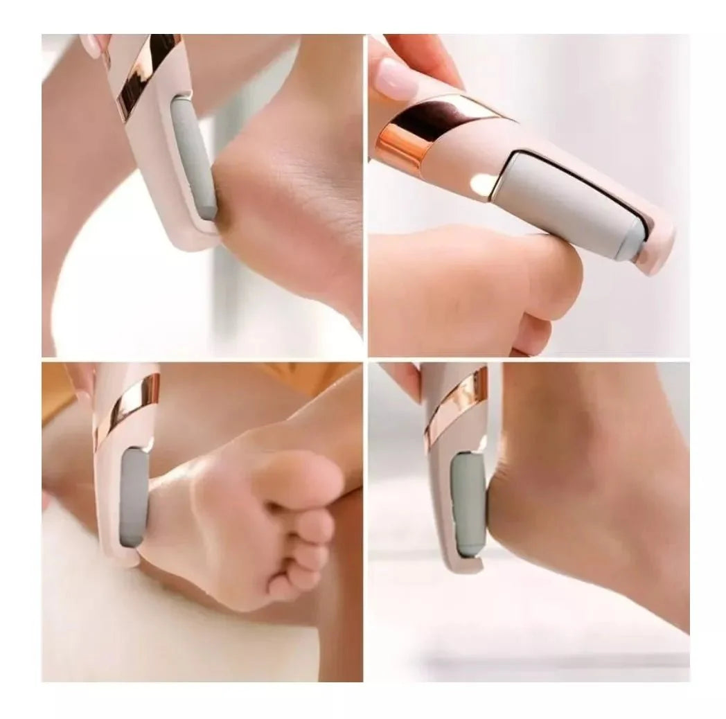 🦶😍 Removedor de callos eléctrico